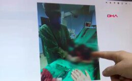 Yıllarca karnındaki 10 kiloluk kitleyle yaşamış