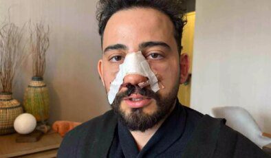 Ankara’da İftar Yemeğinde Darp İddiası: Burnu Kırıldı