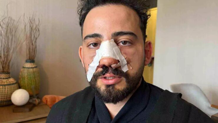 Ankara’da İftar Yemeğinde Darp İddiası: Burnu Kırıldı