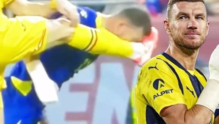 Bakan bir daha bakamıyor! Burnu kırılan Edin Dzeko’nun yüzünün son hali korkunç