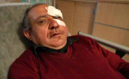 Kırıkkale’de Doktor Darbeden İki Şahıs Serbest Bırakıldı