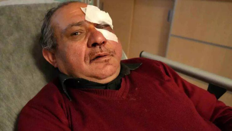 Kırıkkale’de Doktora Darp: Gözünde Kırık Oluştu