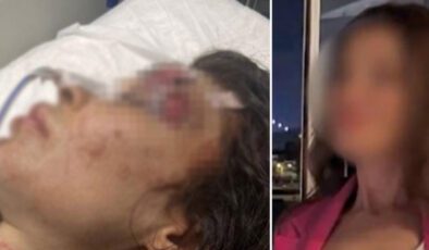 Sibel’i yumrukla darp eden boksör bıçaklamıştı… Kan donduran detaylar ortaya çıktı!