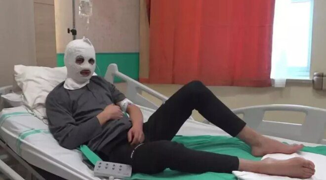 Çakmak gazı faciası! Bomba gibi patladı: Ben yandım, başkası yanmasın